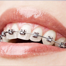 Rögzített készülékek